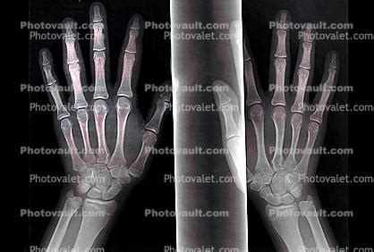 hand, fingers, knuckles, X-Ray, Anatomy, Skeletons, Photo