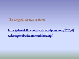 Stages of Wisdom Teeth Healing | PPT