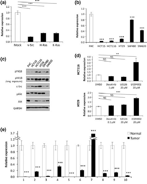 Microrna 27b Mir 27b Is Downregulated In Human Colon Cancer A