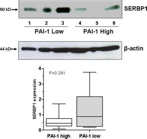 Abundant Serbp1 Expression Is Associated With Low Pai 1 Protein Level Download Scientific