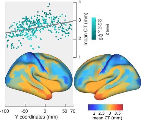 The Frequency Gradient Of Human Resting State Brain Oscillations