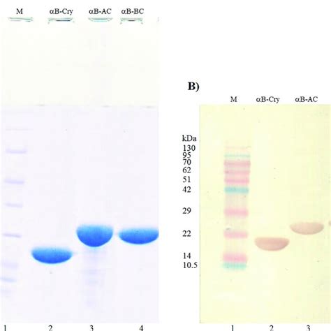 The Sds Page Analysis Of The Fusion Proteins Expression And