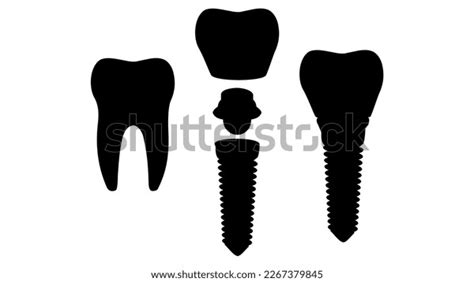 Tooth Silhouette Natural Dental Implant Silhouettes Stock Vector