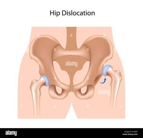 Anatomy Hip Joint Diagram Hi Res Stock Photography And Images Alamy