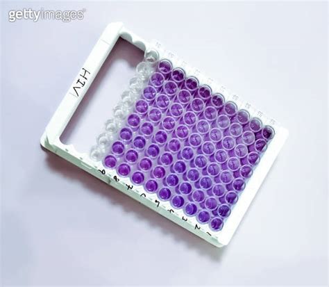 Enzyme Linked Immunosorbent Assay Elisa Plate Immunology Or Serology