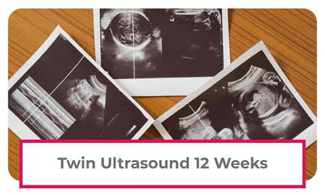 Twin Ultrasound 12 Weeks: Dating & Chorionicity Scan – About Twins