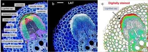 Cellular organization of a late stage of lateral root development... | Download Scientific Diagram