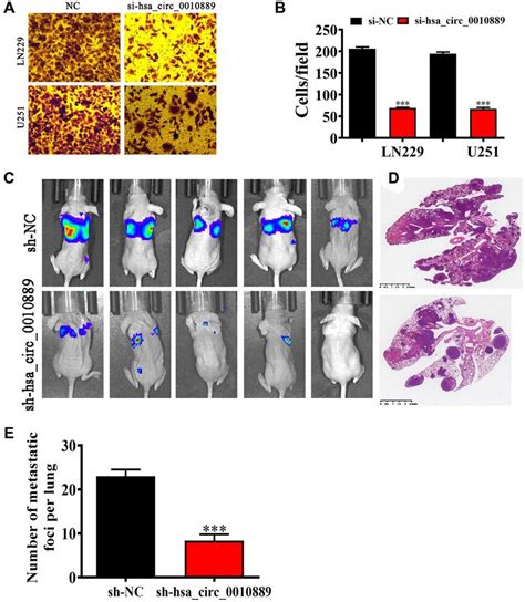 Downregulation Of Hsa Circ 0010889 Suppressed Glioma Migration And