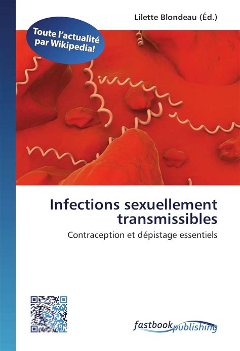 Infections Sexuellement Transmissibles Contraception Et