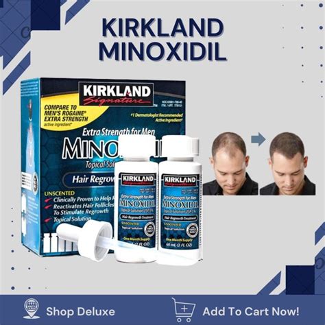 Kirkland Signature Kirkland Minoxidil 5 Extra Strength Hair Loss