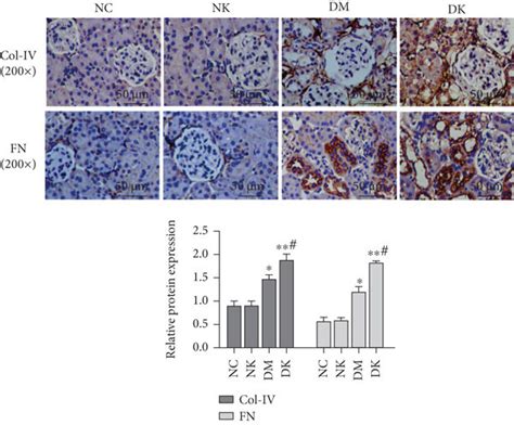 A The Expression Of Collagen Iv And Fibronectin In Renal Tissues Of