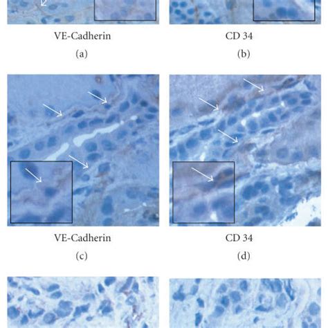 Immunohistochemical staining grade of VE-Cadherin on endothelial... | Download Scientific Diagram