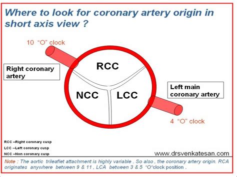 Left Main Coroanry Artery Drsvenkatesan Md