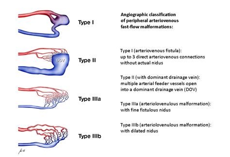 Compva Imaging Arteriovenous Malformation