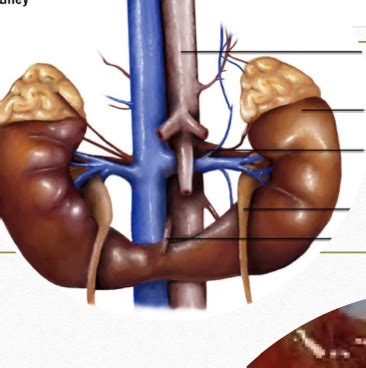 Pediatric Nephrology And Urology Flashcards Quizlet