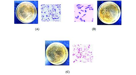 Morphological Characters And Gram Stain For Three Bacterial Strains A