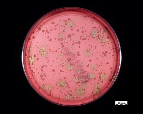 Difference Between Alpha and Beta Hemolysis – Pediaa.Com