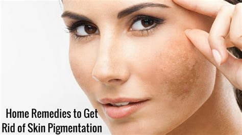 13 Best Home Remedies to Get Rid of Skin Pigmentation