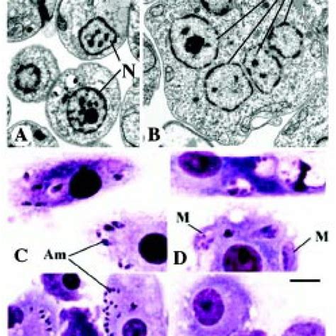 Transmission Electron Micrograph Of L Donovani Wild Type A And