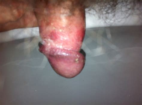 Cut Cock Makes Cheese Photo Album By Cheesehungry XVIDEOS