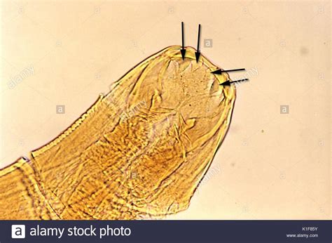 Ancylostoma Duodenale Hi Res Stock Photography And Images Alamy