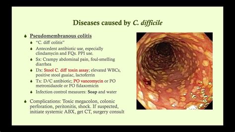 Pseudomembranous Colitis Stool