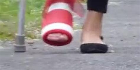 Leg Cast Lesbian Tnaflix