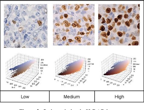 Figure From A Deep Learning Pipeline For Breast Cancer Ki