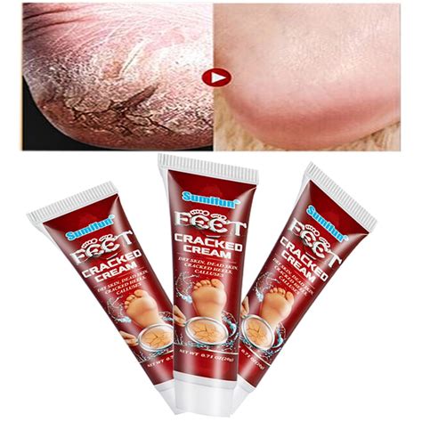 Hand Foot Crack Cream Heel Chapped Peeling Anti Dry Repair Moisturized