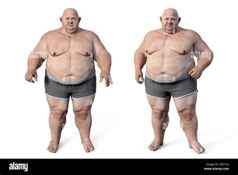 Obese man standing, illustration Stock Photo - Alamy