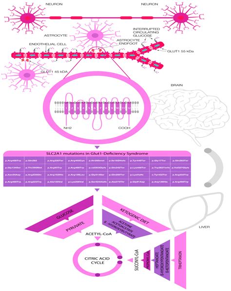 Glucose Transporter Type 1 Glut1 Deficiency Syndrome - Transport Informations Lane