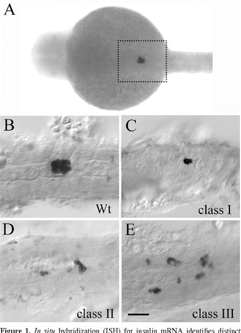 Figure 1 from Zebrafish as a Developmental Model Organism for Pediatric ...