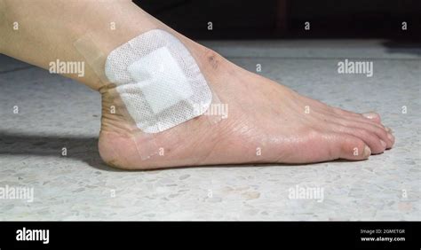 Wound bleeding hi-res stock photography and images - Alamy