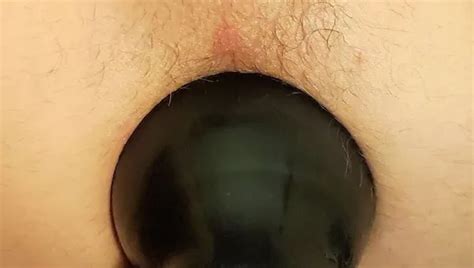 Anal Inflatable Dilation Of The Naughty Husband Nude Pics Xhamster