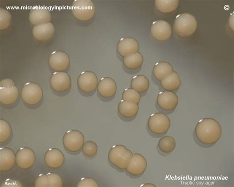 Klebsiella Pneumoniae Morphology