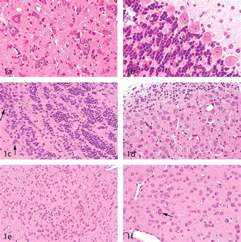 Cerebral Cortex Histology Labeled