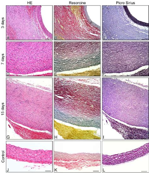 A I Histological Images Of Aortic Aneurysms At And Dps In