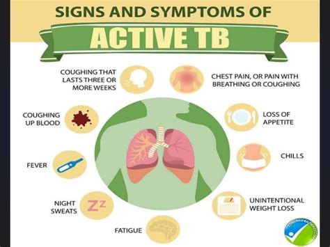 Tuberculosis | PPT