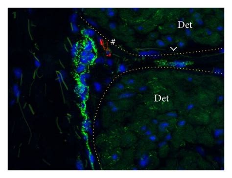 N-Cadherin positive strings and interfascicular cells. N-Cadherin ...