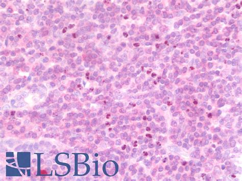 Ihc Plus Il Polyclonal Antibody Rabbit Anti Human Lsbio