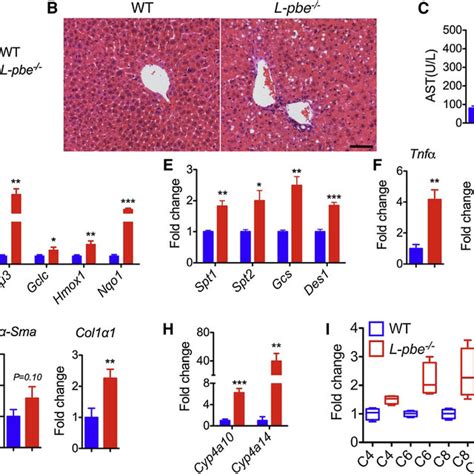 Lard Based Hfd L Does Not Induce Liver Damage In L Pbe−− Mice Related