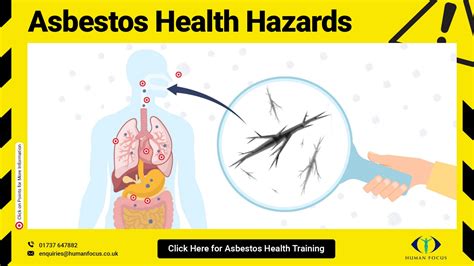 Free Asbestos Health Hazards Infographic By HaiderBakht Issuu