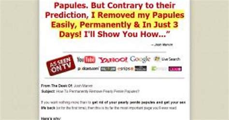 Review Of Pearly Penile Papules Removal Imgur