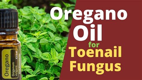 Is Oregano Oil Good For Toenail Fungus It Kills Fungus Youtube