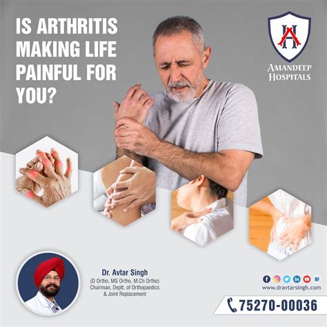 Arthritis symptoms – Artofit