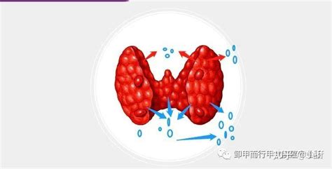 8 19：甲状腺的分区方法和对应区域甲状腺癌的风险特征 知乎