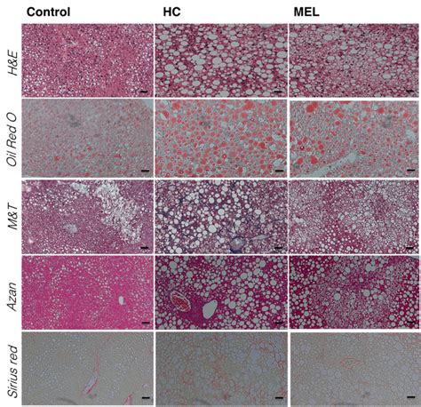 Histological Analysis Of The Liver Of The Mouse Model Of A High Fat