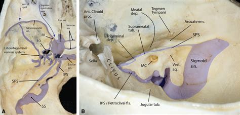 Frontiers Comprehensive Microsurgical Anatomy Of The Middle 44 Off