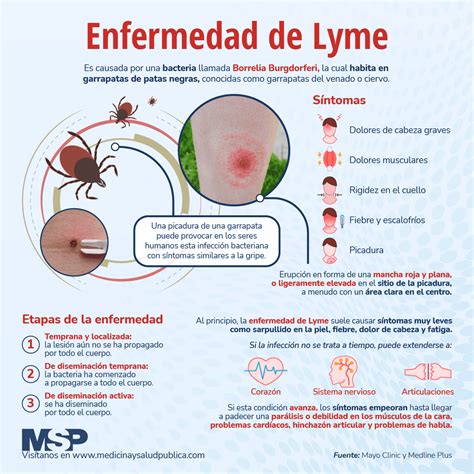 Enfermedad de Lyme Infografía