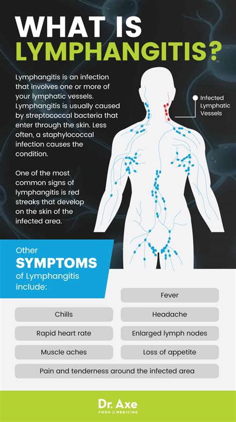 Lymphangitis Signs + 7 Natural Treatments for Symptoms - Dr. Axe